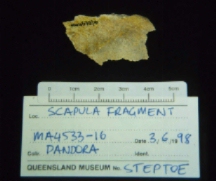 Scapular bony fragment