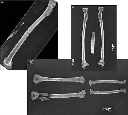 Composite images of bone X-rays