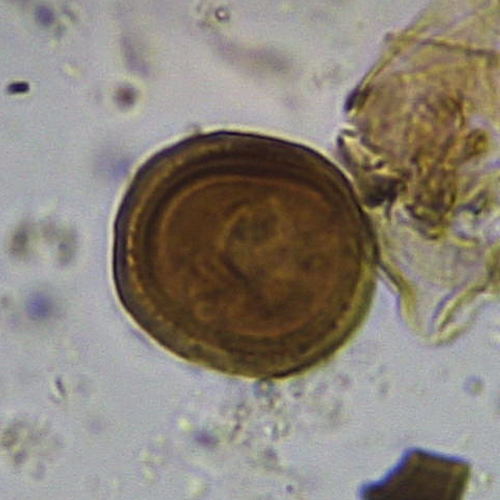 a microscopic snapshot of a Cestode egg